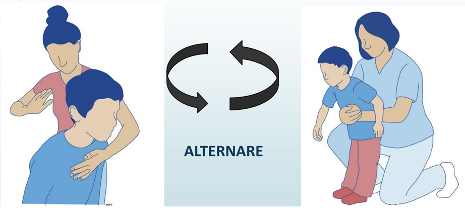 Disostruzione bambino: colpi tra le scapole e compressioni addominali dietro al bambino